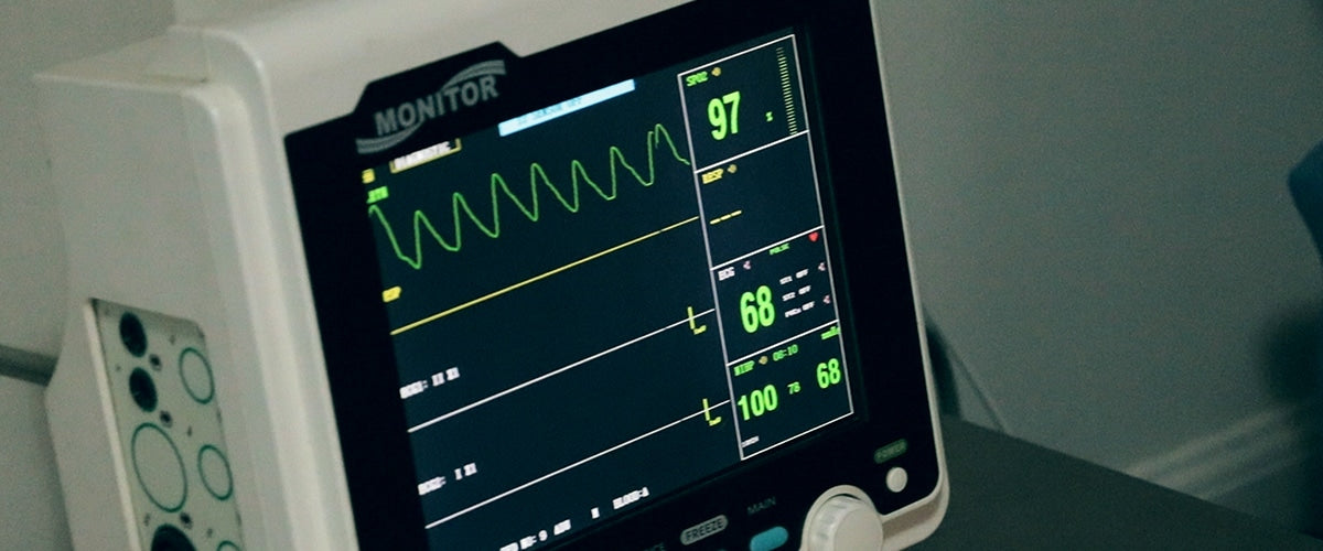 abnormal ekg