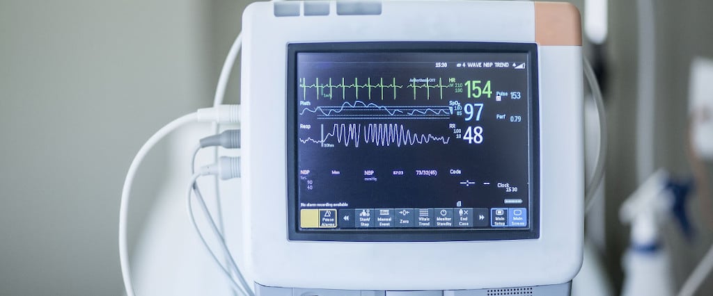 Electrocardiography-Monitor